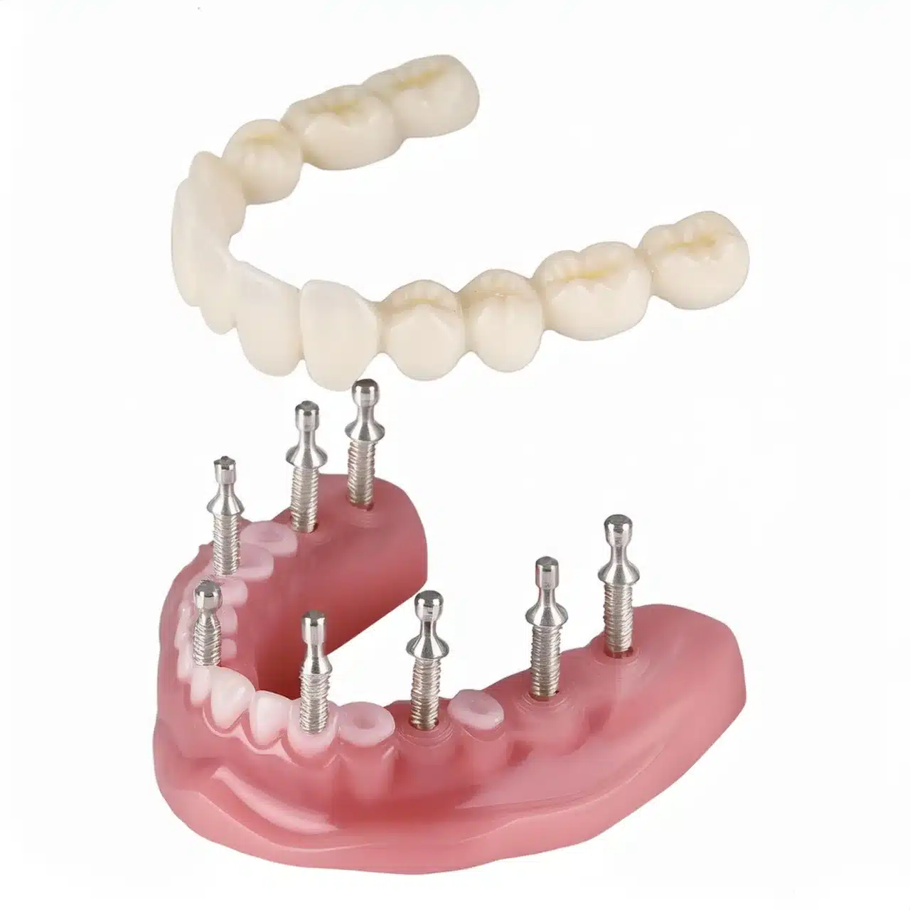 8 Implantes