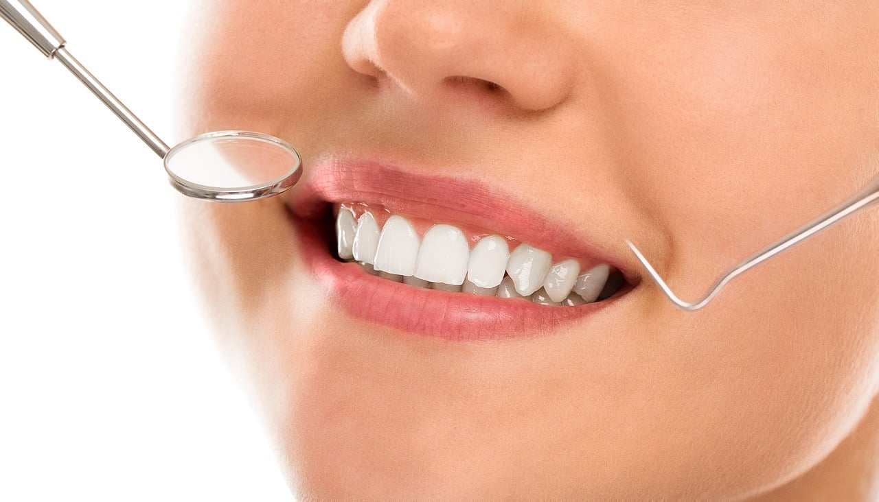 blanqueamiento dental