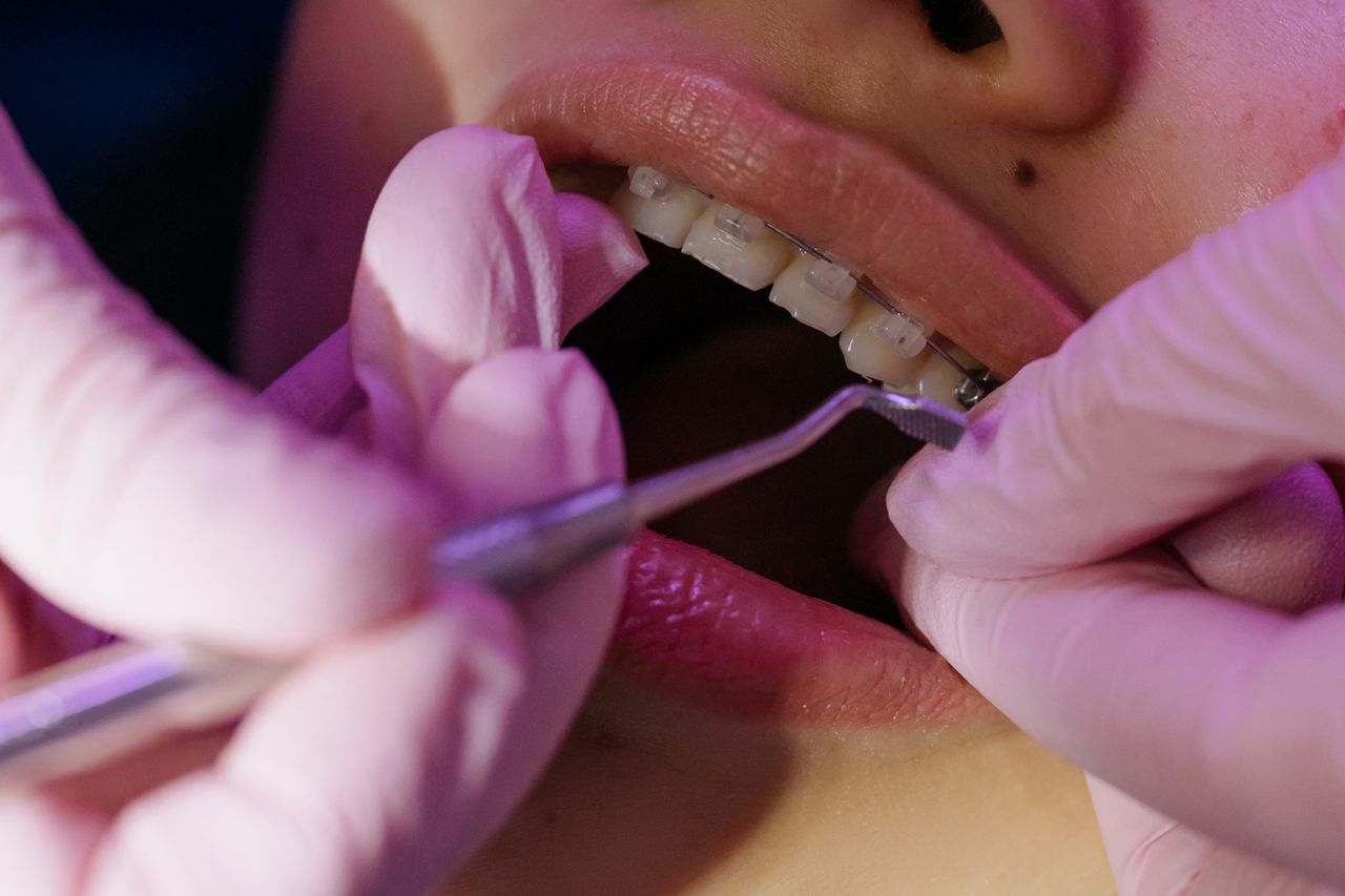 Brackets metálicos