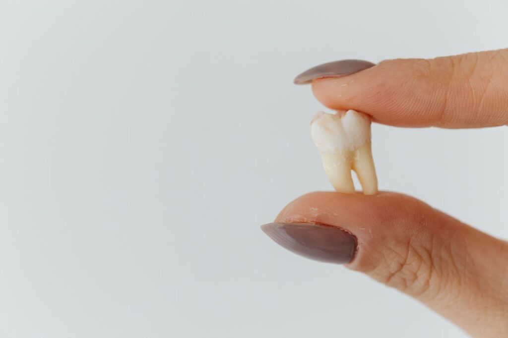 Implantes Dentales en Lugo