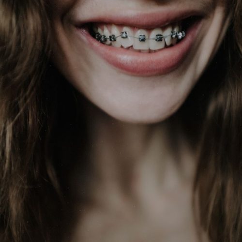 Crop positive female with nose piercing smiling happily and showing upper teeth braces